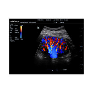 M7 Premium Colour Doppler Ultrasound System